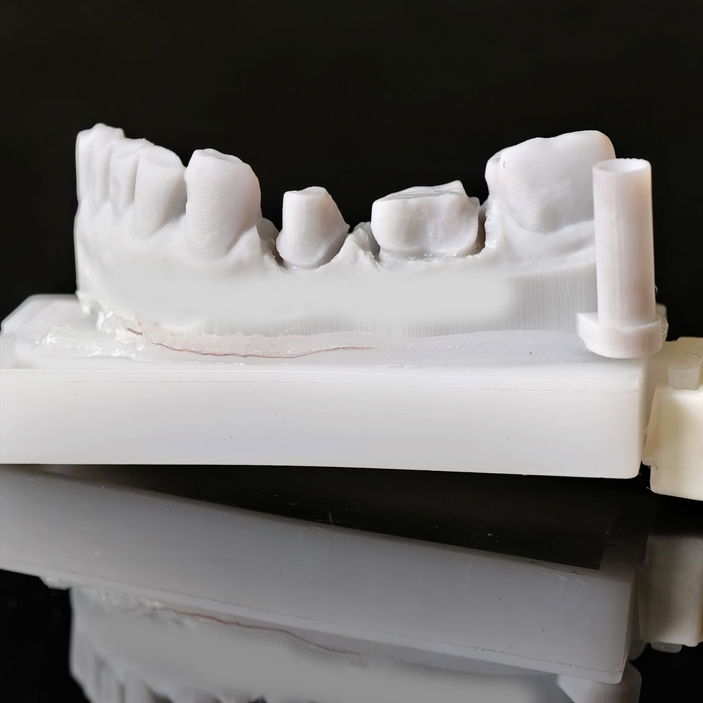 High - Strength Zirconia Dental Crowns
