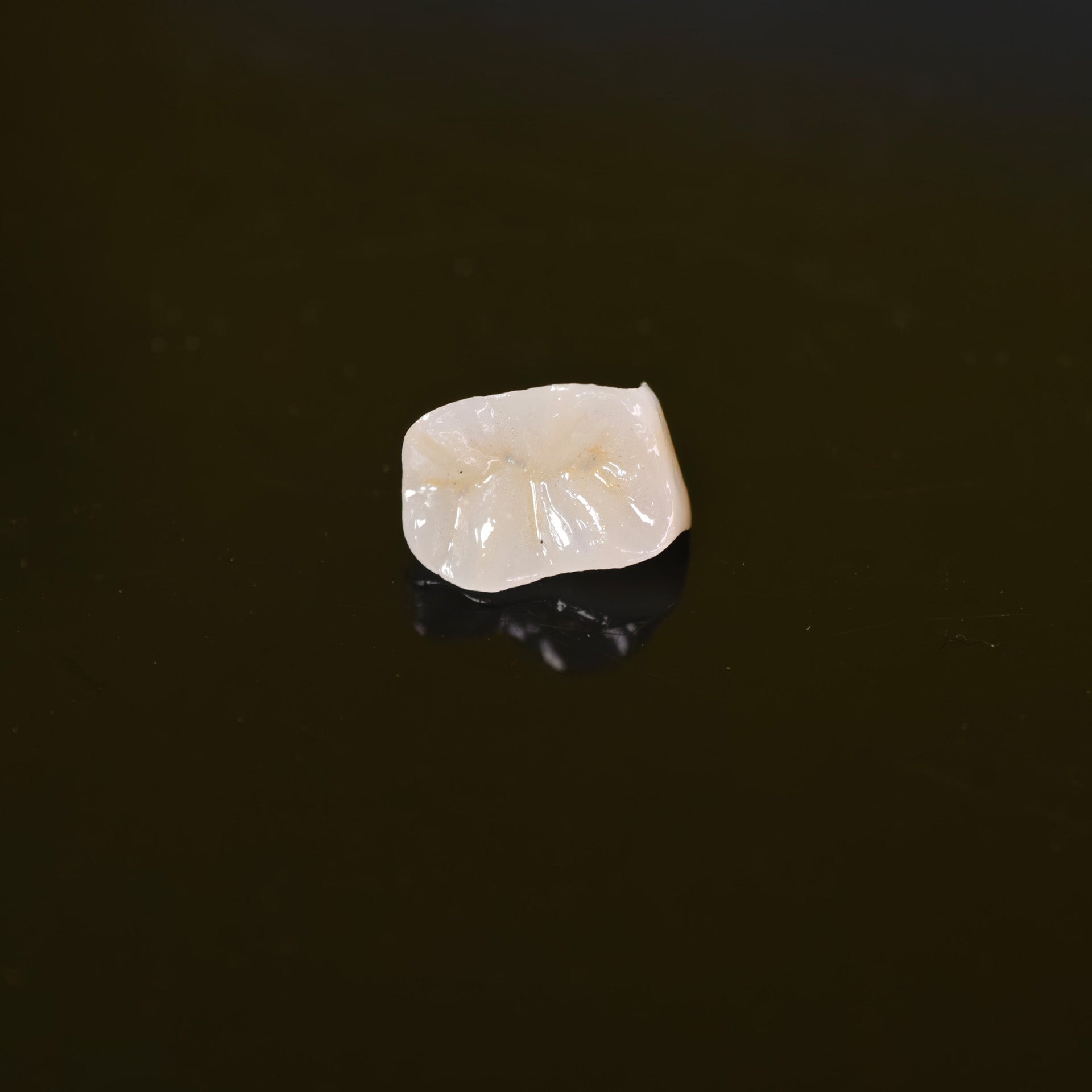 High - Strength Zirconia Inlay And Crown