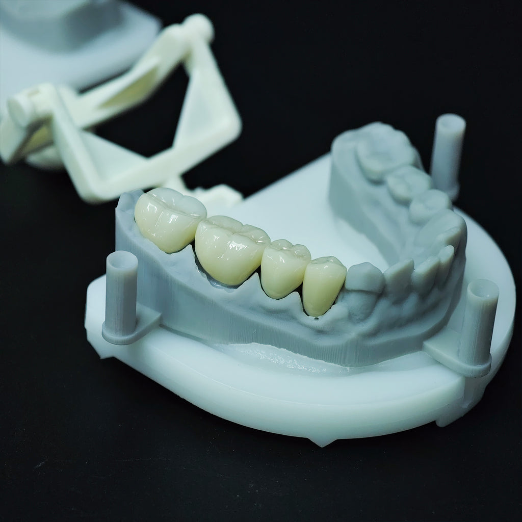 High - Strength Zirconia Crowns