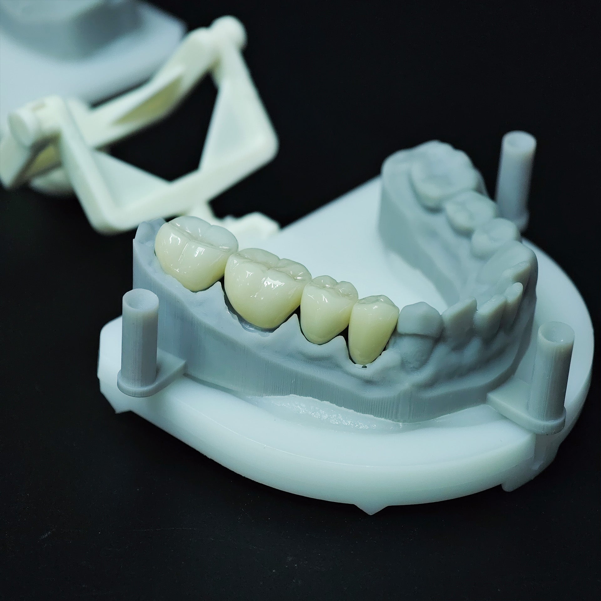 High - Strength Zirconia Crowns