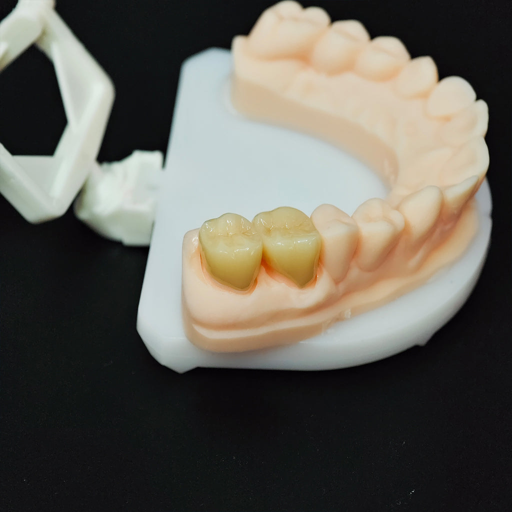 High - Strength Zirconia Crowns