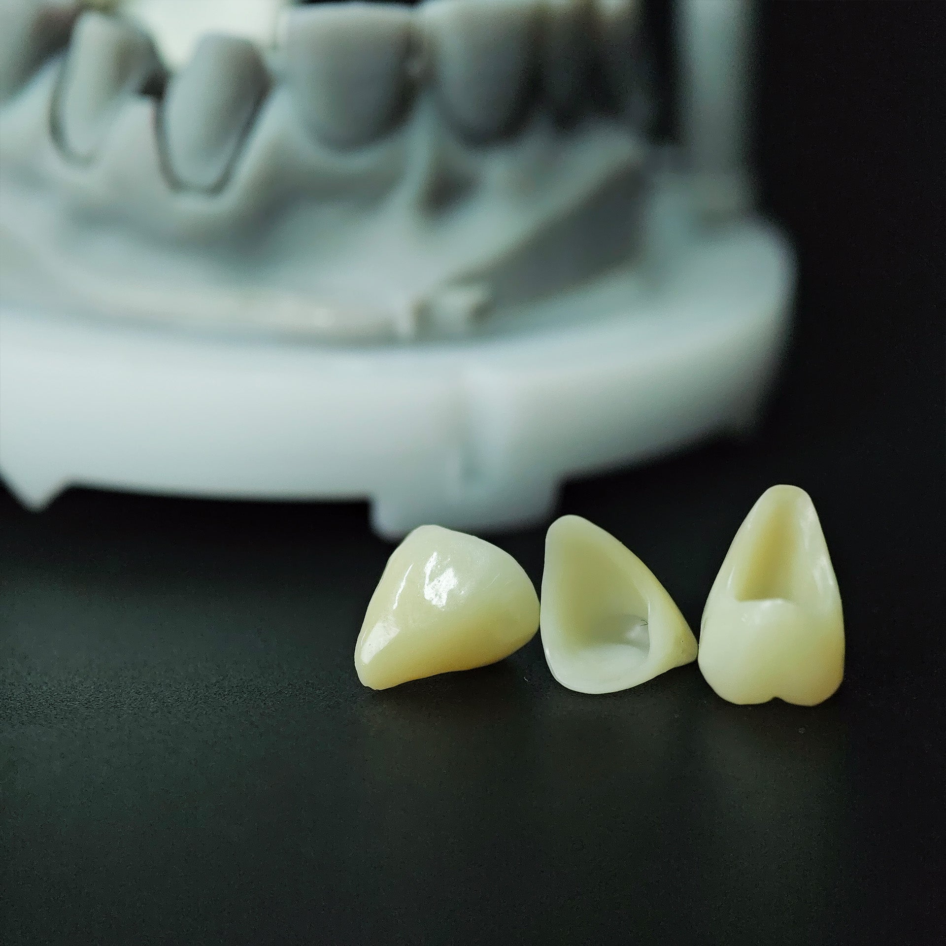High - Strength Zirconia Crowns