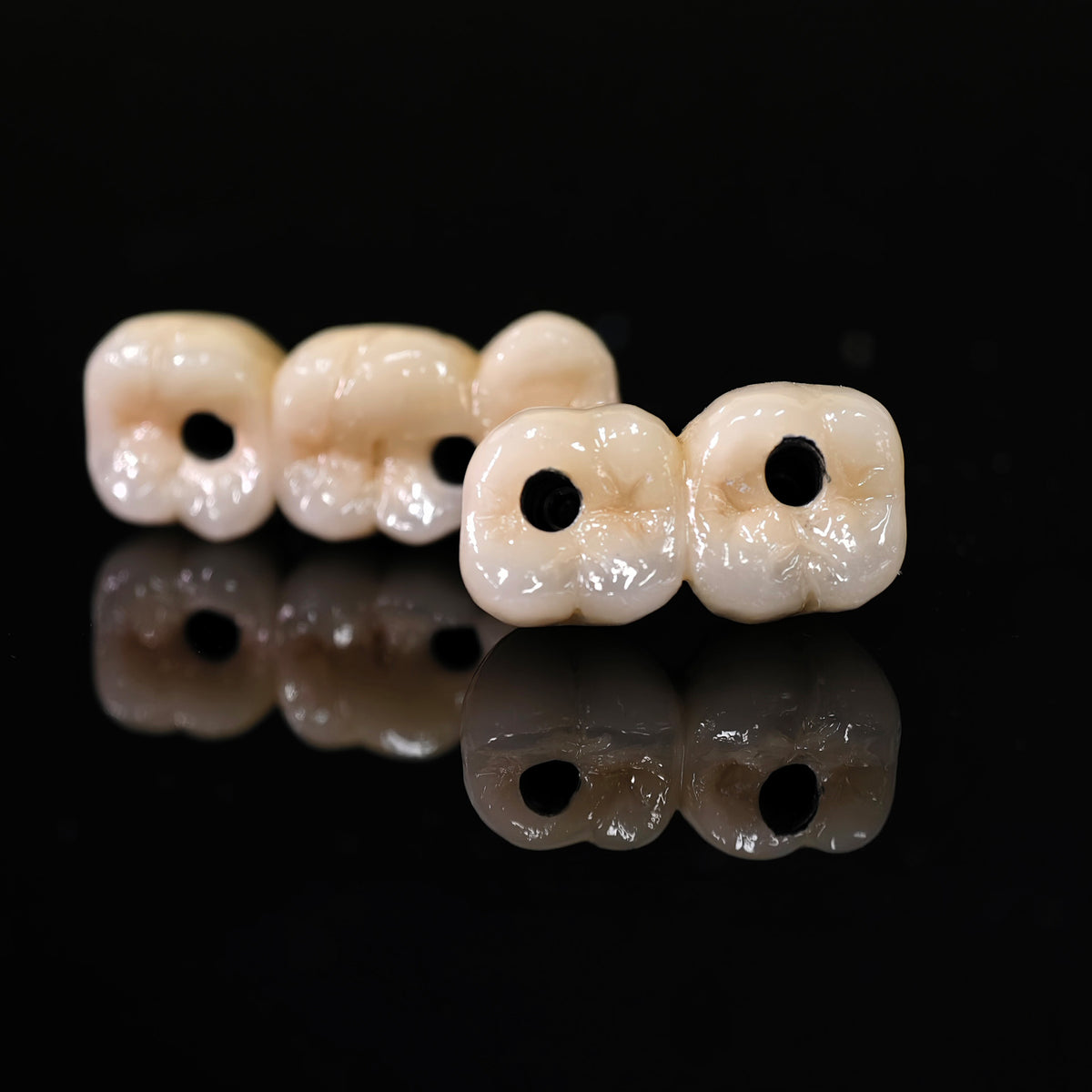 Implant-supported Co - Cr PFM Dental Bridge