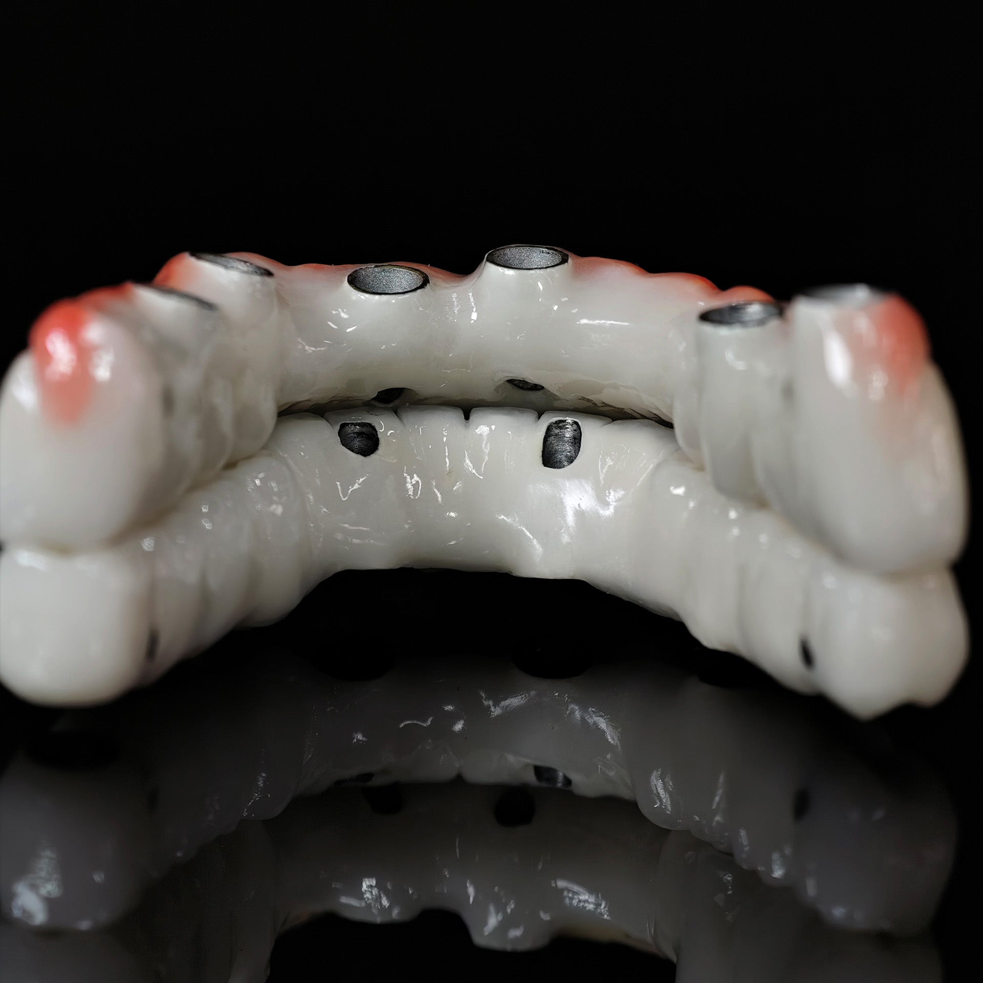 Implant-supported Co - Cr PFM Dental Bridge