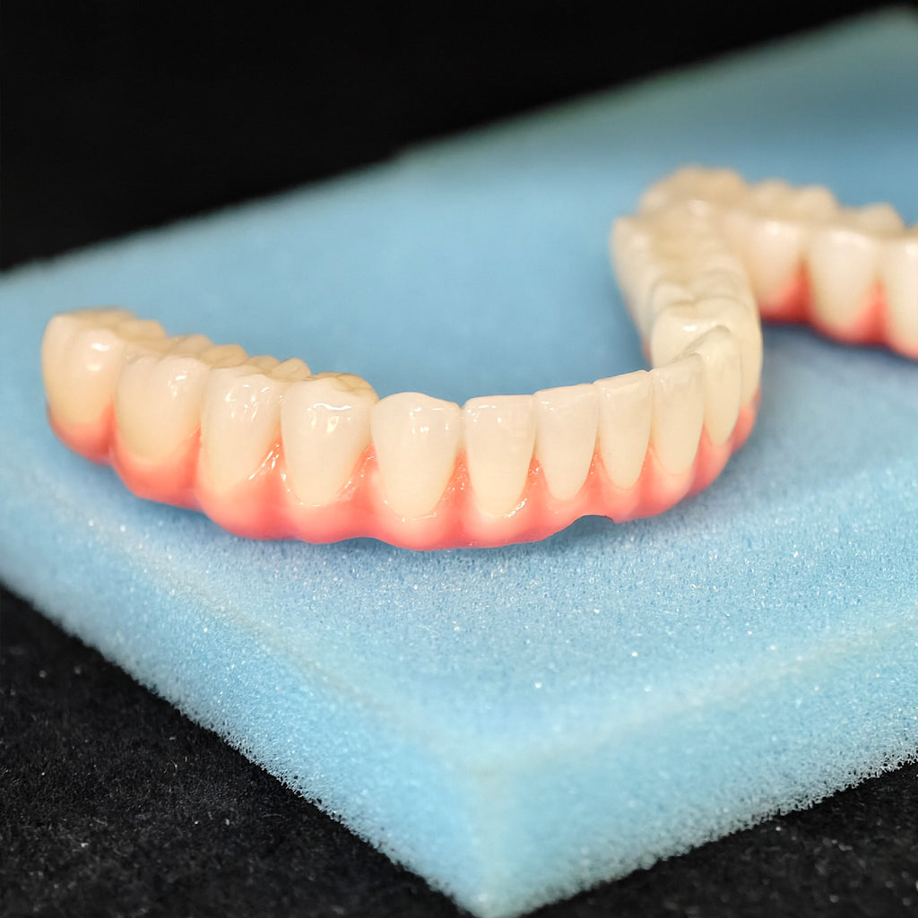 Malo Bridge Implant Restorations