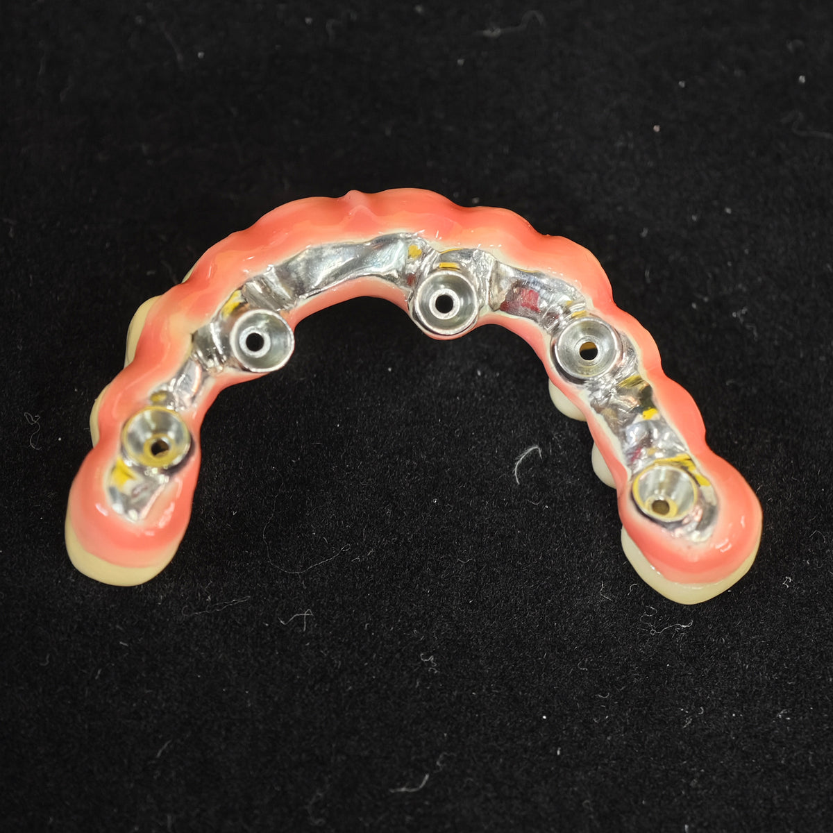 Malo Bridge With Exposed Titanium Framework