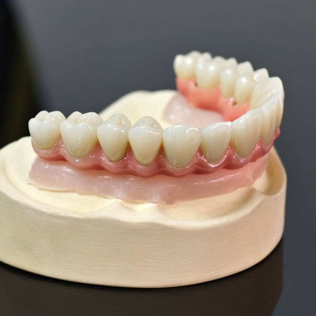 Malo Bridge With Gold-Plated Grade 5 Pure Titanium Malo Bridge
