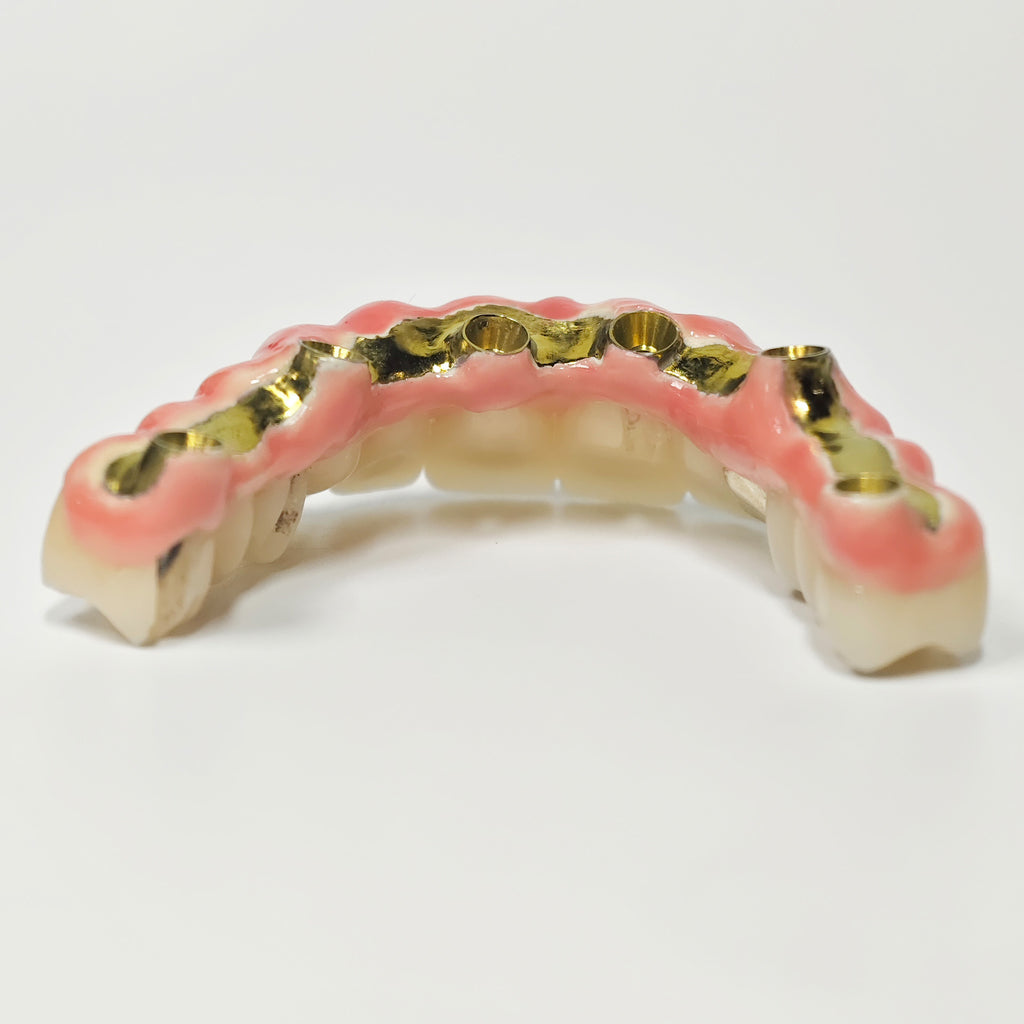 Malo Bridge With Gold-Plated Titanium Framework And A Gold Crown