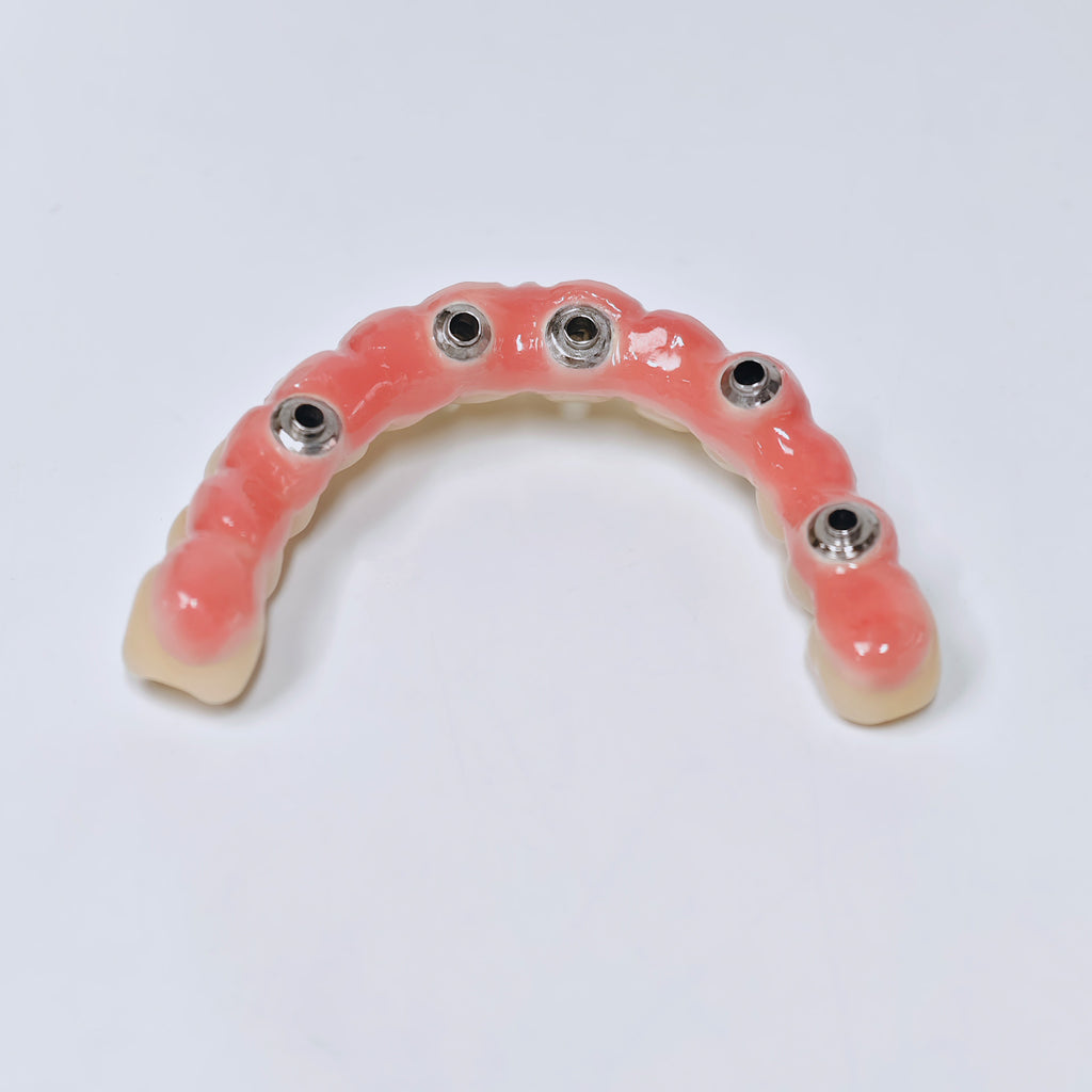 Malo Bridge With Screw-Retained