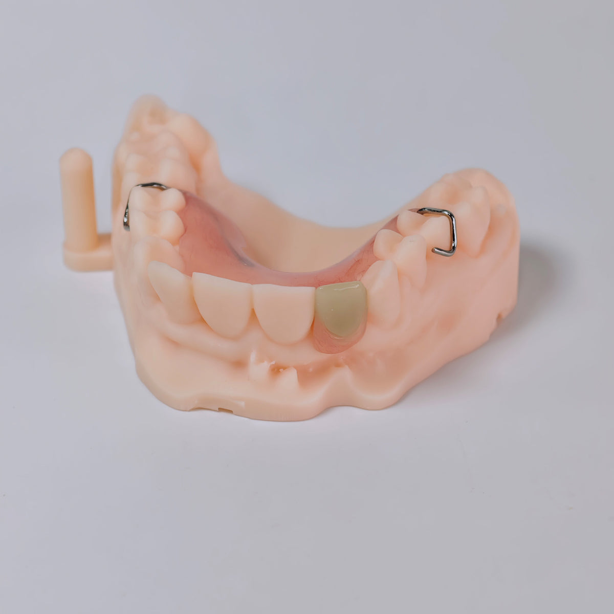Metal Clasp Partial Denture