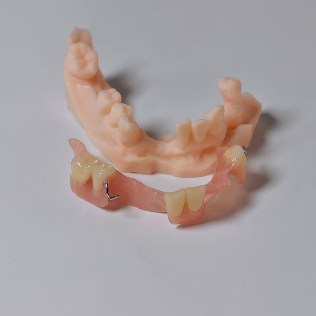 Metal Clasp Partial Denture