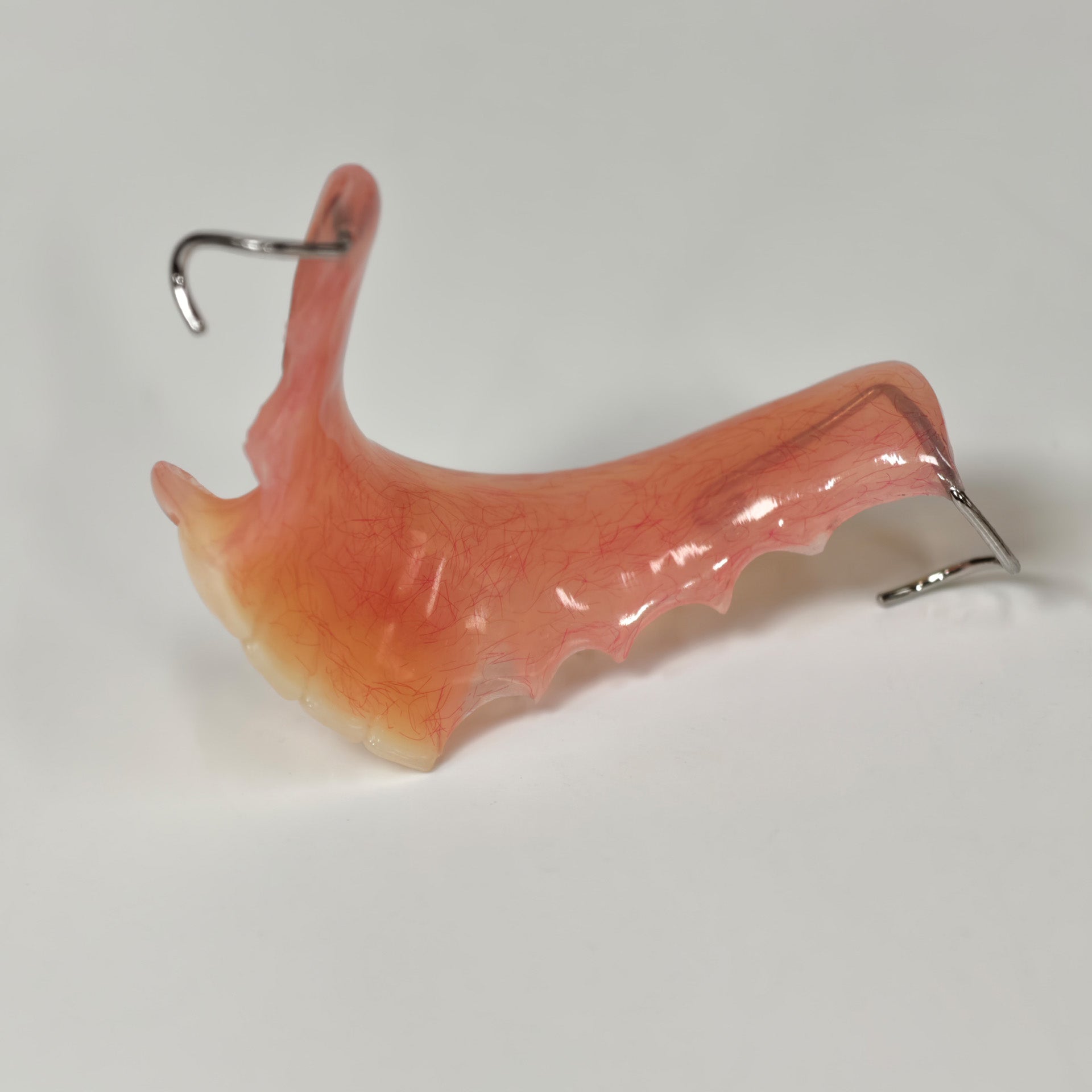 Metal Clasp Partial Denture