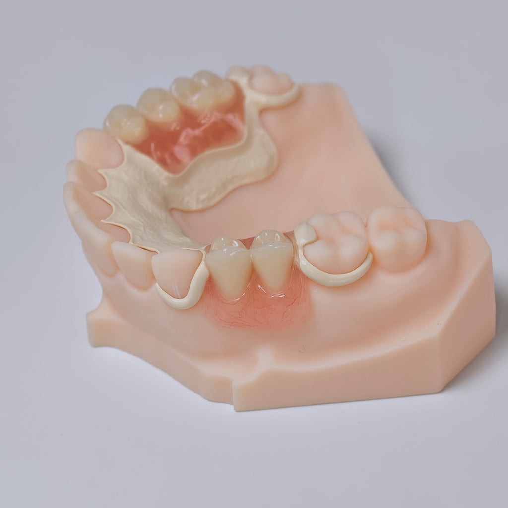 PEEK Framework Denture Metal Framework With Acrylic Denture