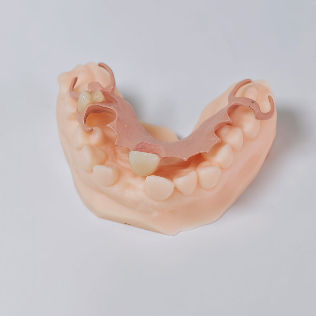 PEEK Framework Denture Metal Framework With Acrylic Denture