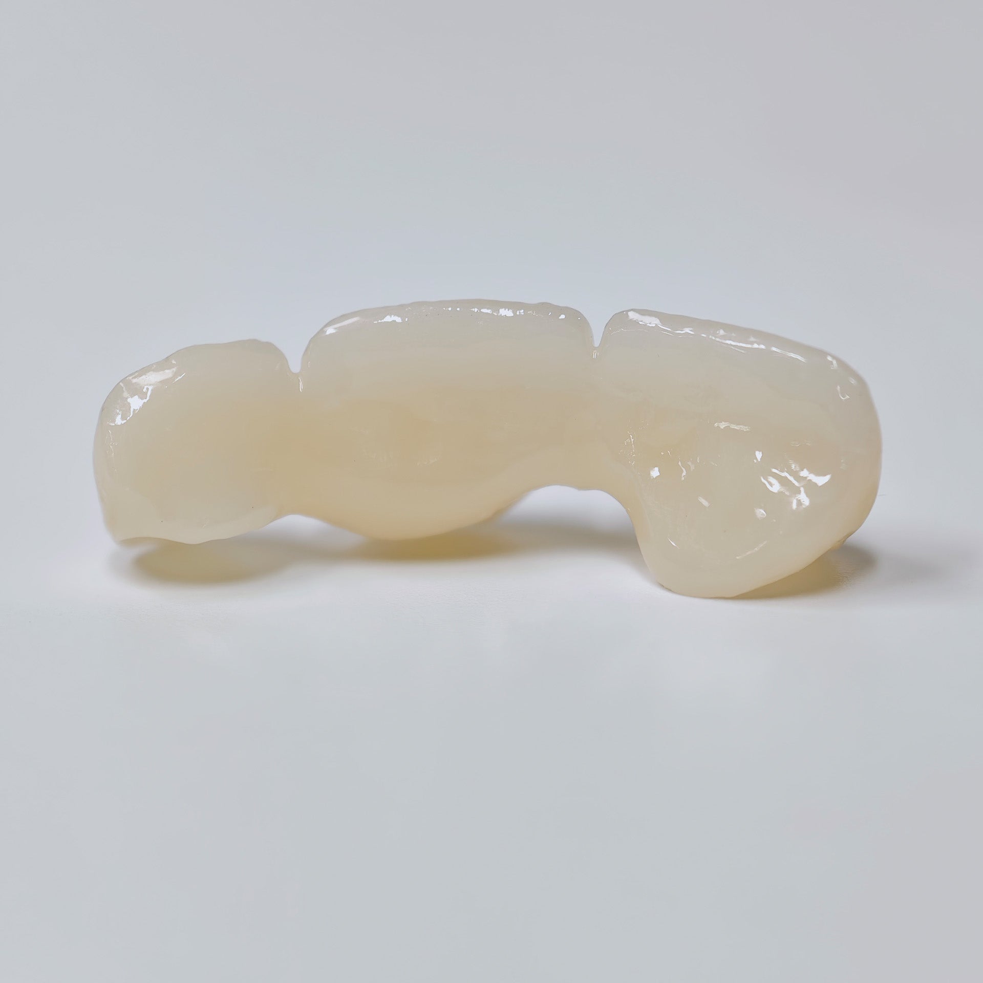 PFZ Dental Bridge – Depth And Aesthetics