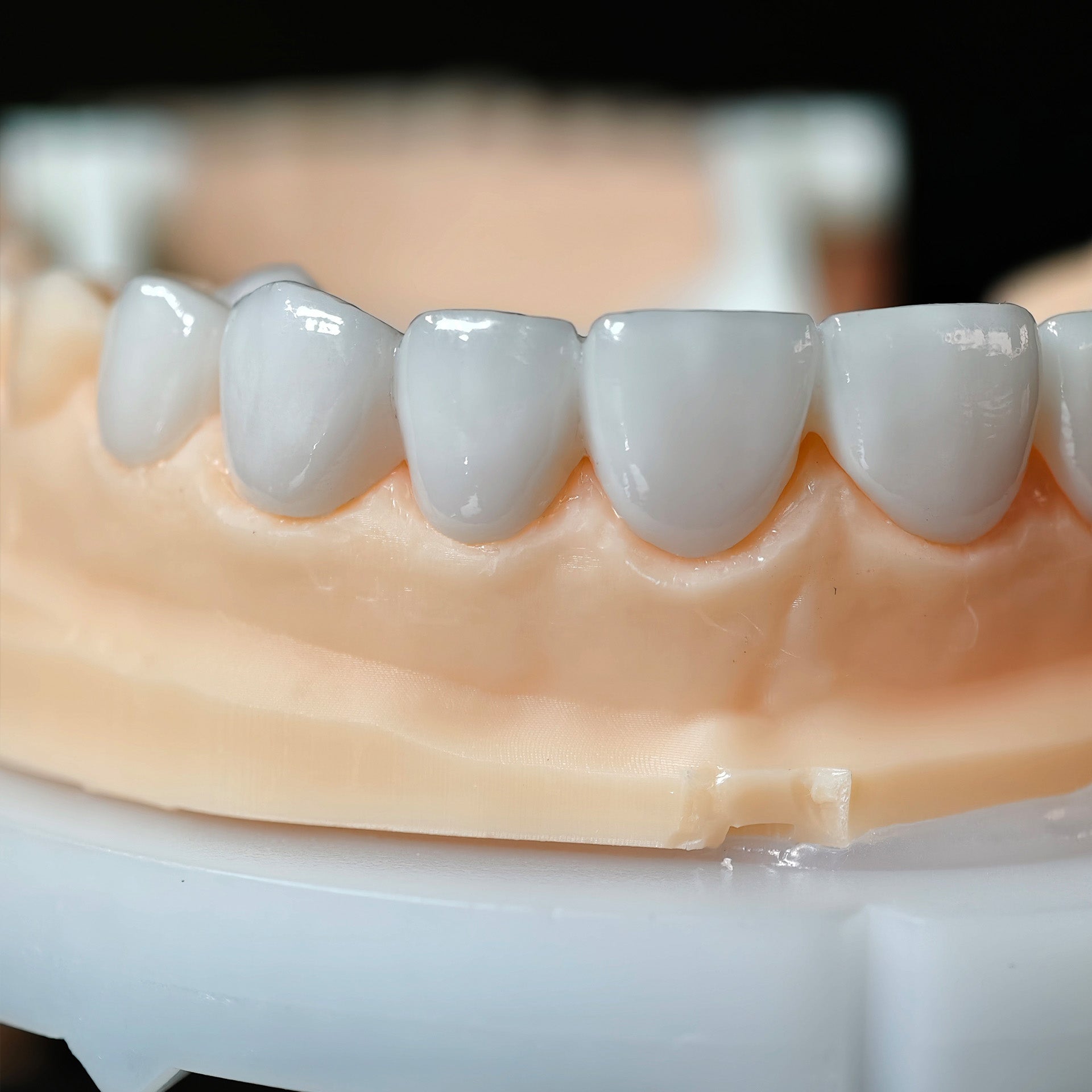 PFZ Porcelain Fused Zirconia Aidite Zirconia