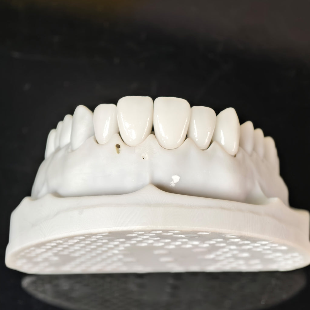 PFZ Porcelain Fused Zirconia Aidite Zirconia