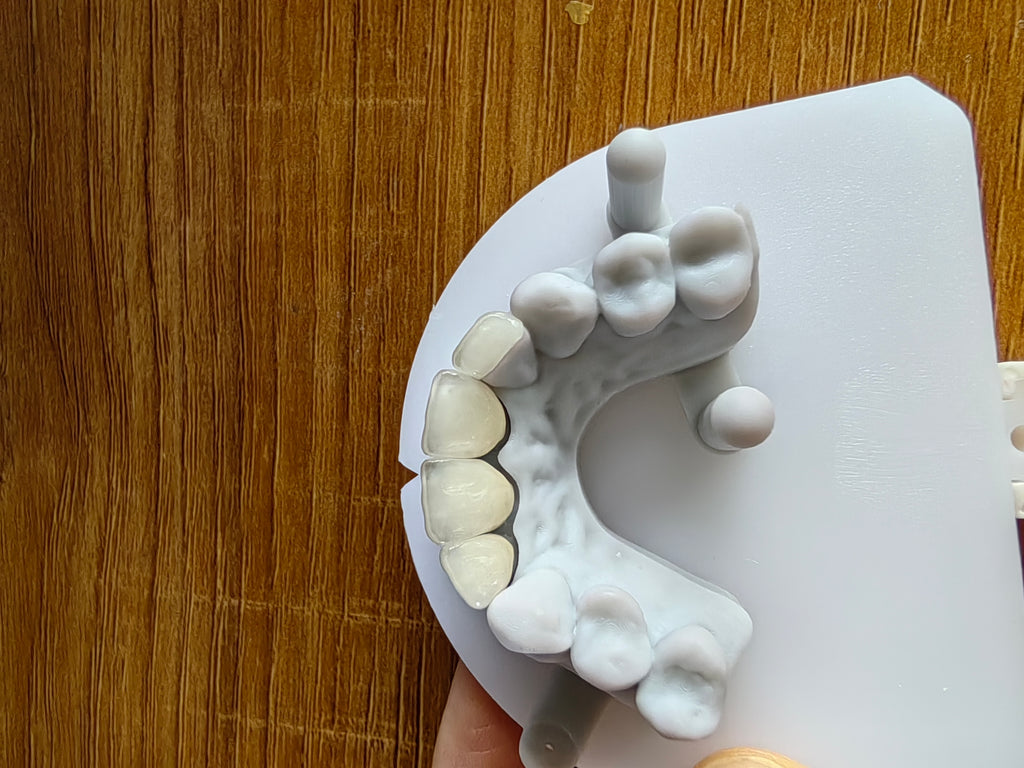 PFZ With Transparent In Incisal