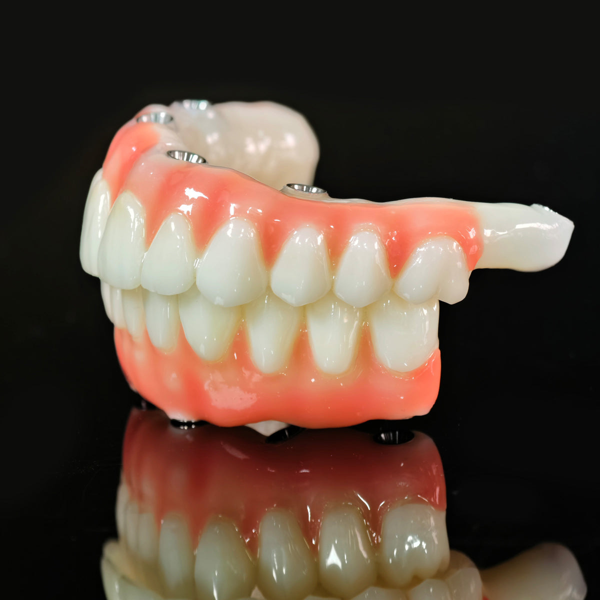 PMMA Bridge With Ti-Base Screw Retained Trying For Full Arch Restoration