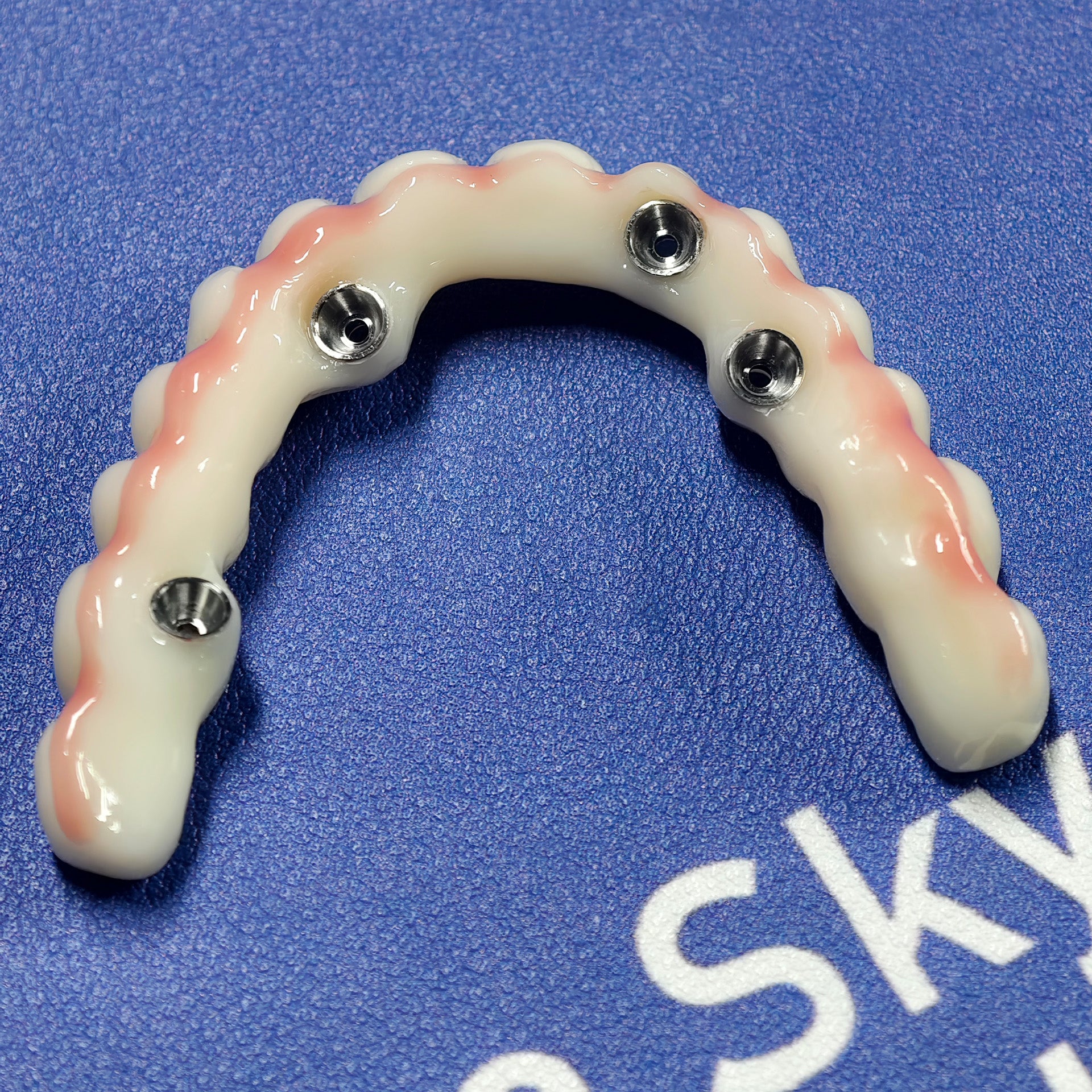 PMMA Bridge With Ti-Base Screw Retained Trying For Full Arch Restoration