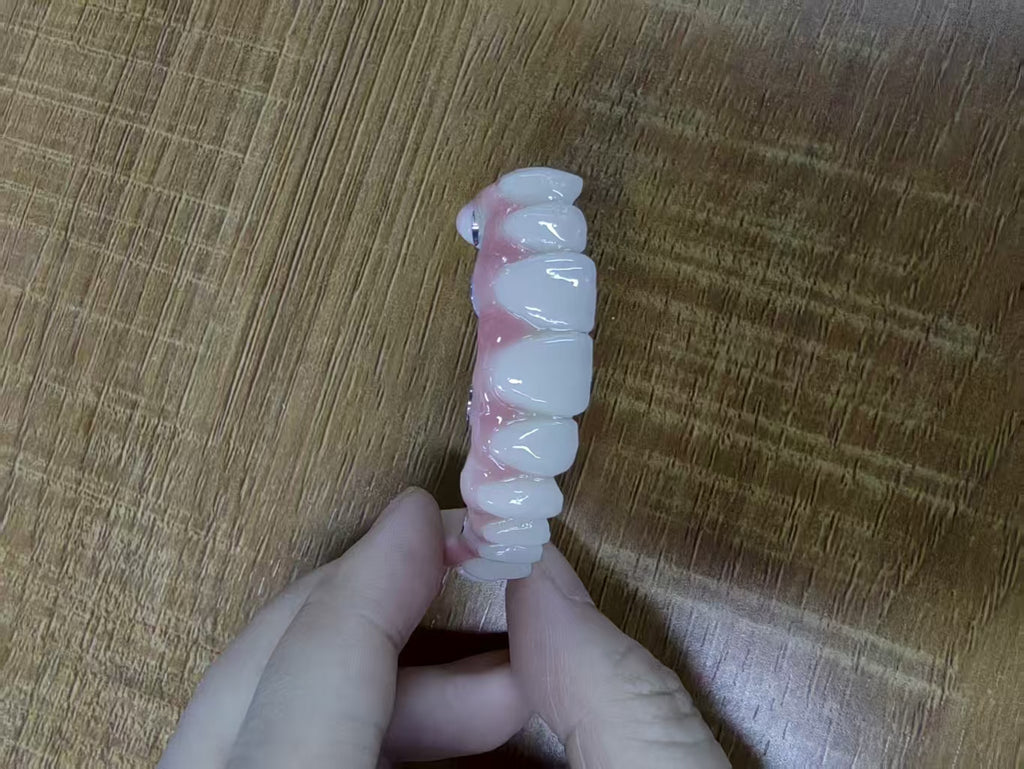 PMMA Bridge With Ti-Base Screw Retained Trying For Full Arch Restoration