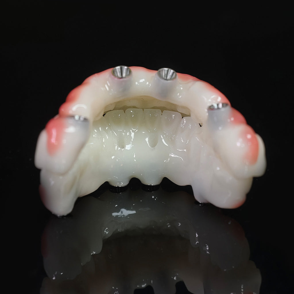 PMMA Bridge With Ti-Base Screw Retained Trying For Full Arch Restoration