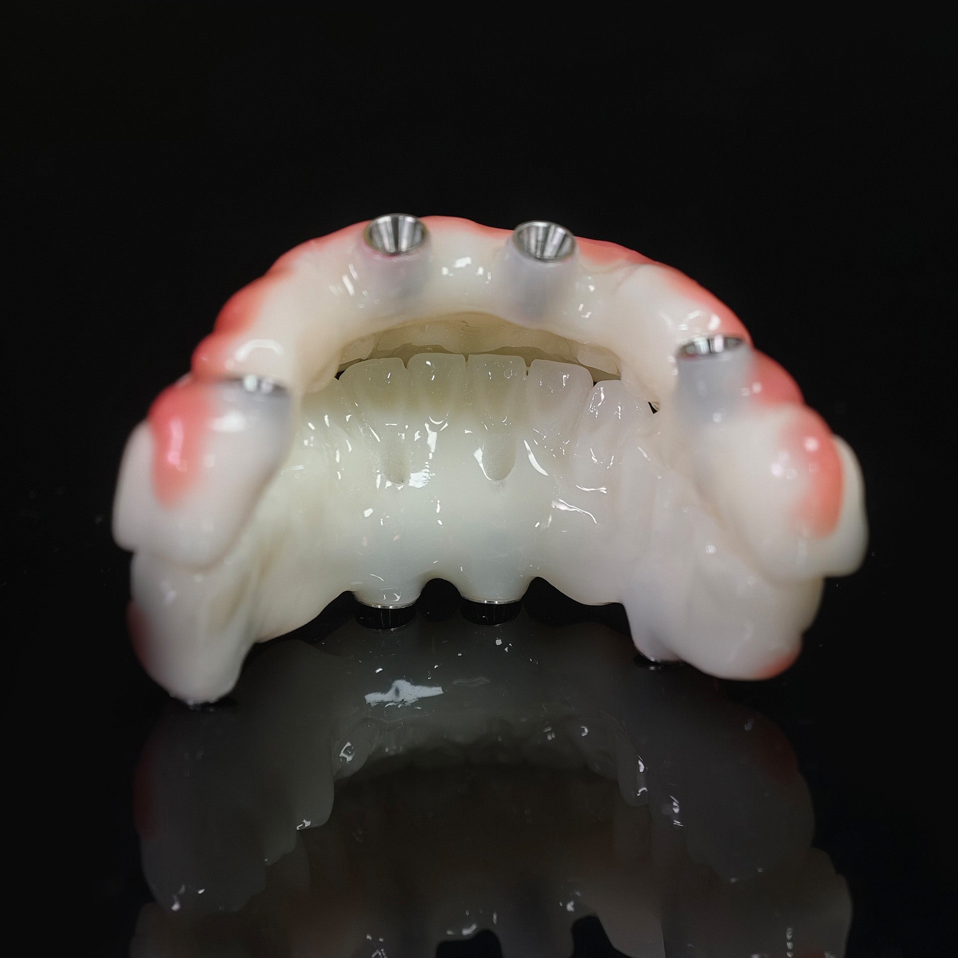PMMA Bridge With Ti-Base Screw Retained Trying For Full Arch Restoration