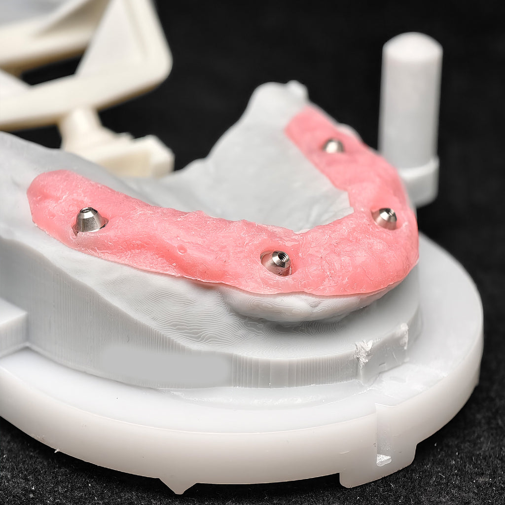 PMMA Bridge With Ti-Base Screw Retained Trying For Full Arch Restoration