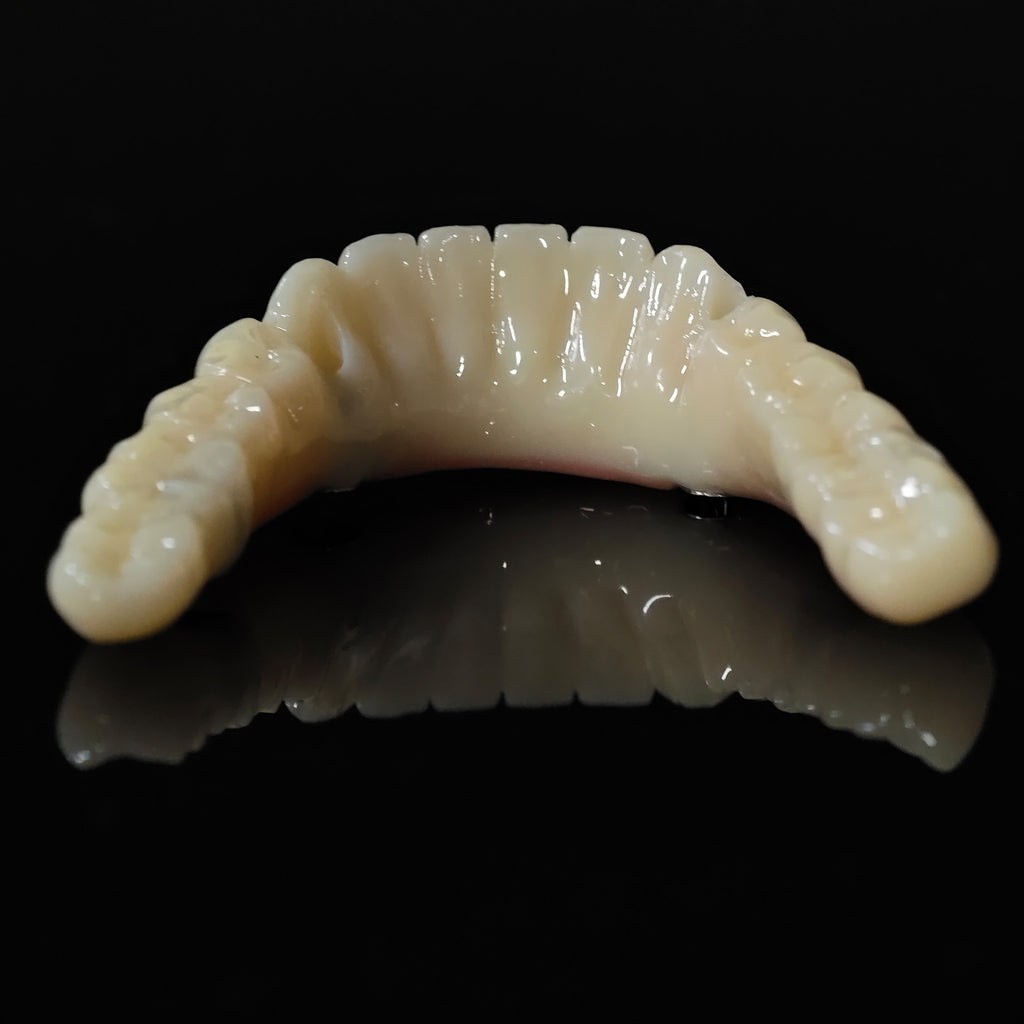 PMMA Bridge With Ti-Base Screw Retained Trying For Full Arch Restoration
