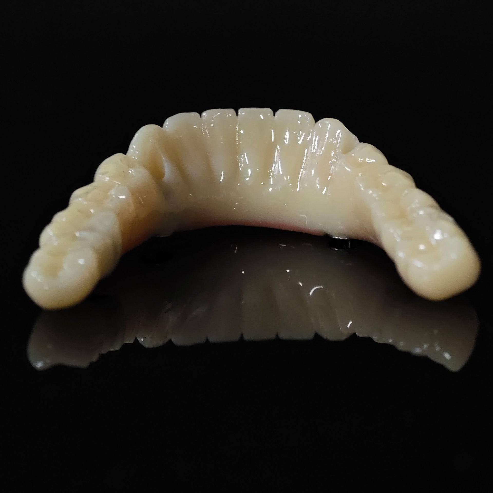 PMMA Bridge With Ti-Base Screw Retained Trying For Full Arch Restoration