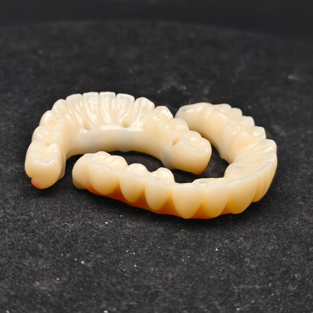 PMMA Bridge With Ti-Base Screw Retained Trying For Full Arch Restoration