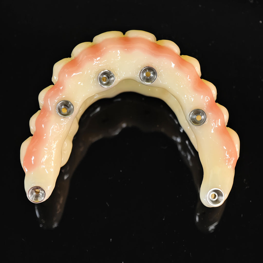PMMA Bridge With Ti-Base Screw Retained Trying For Full Arch Restoration
