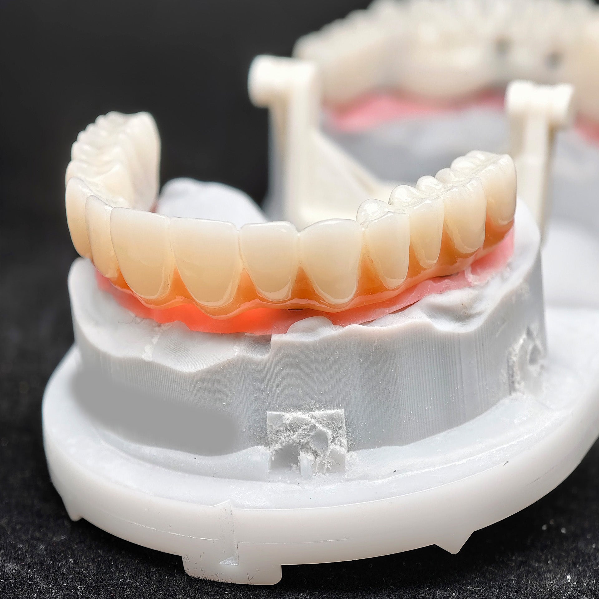 PMMA Bridge With Ti-Base Screw Retained Trying For Full Arch Restoration