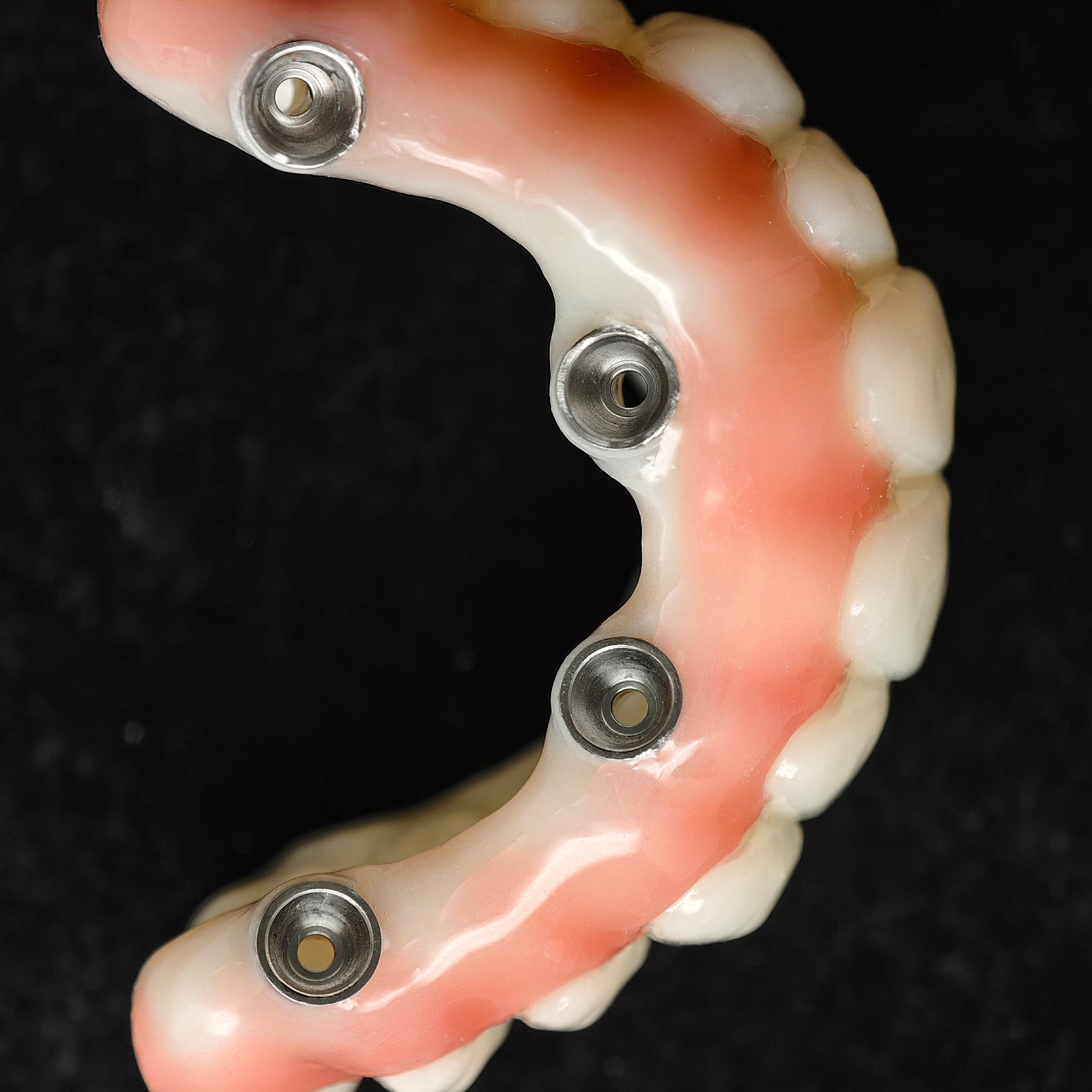 PMMA Bridge With Ti-Base Screw Retained Trying For Full Arch Restoration