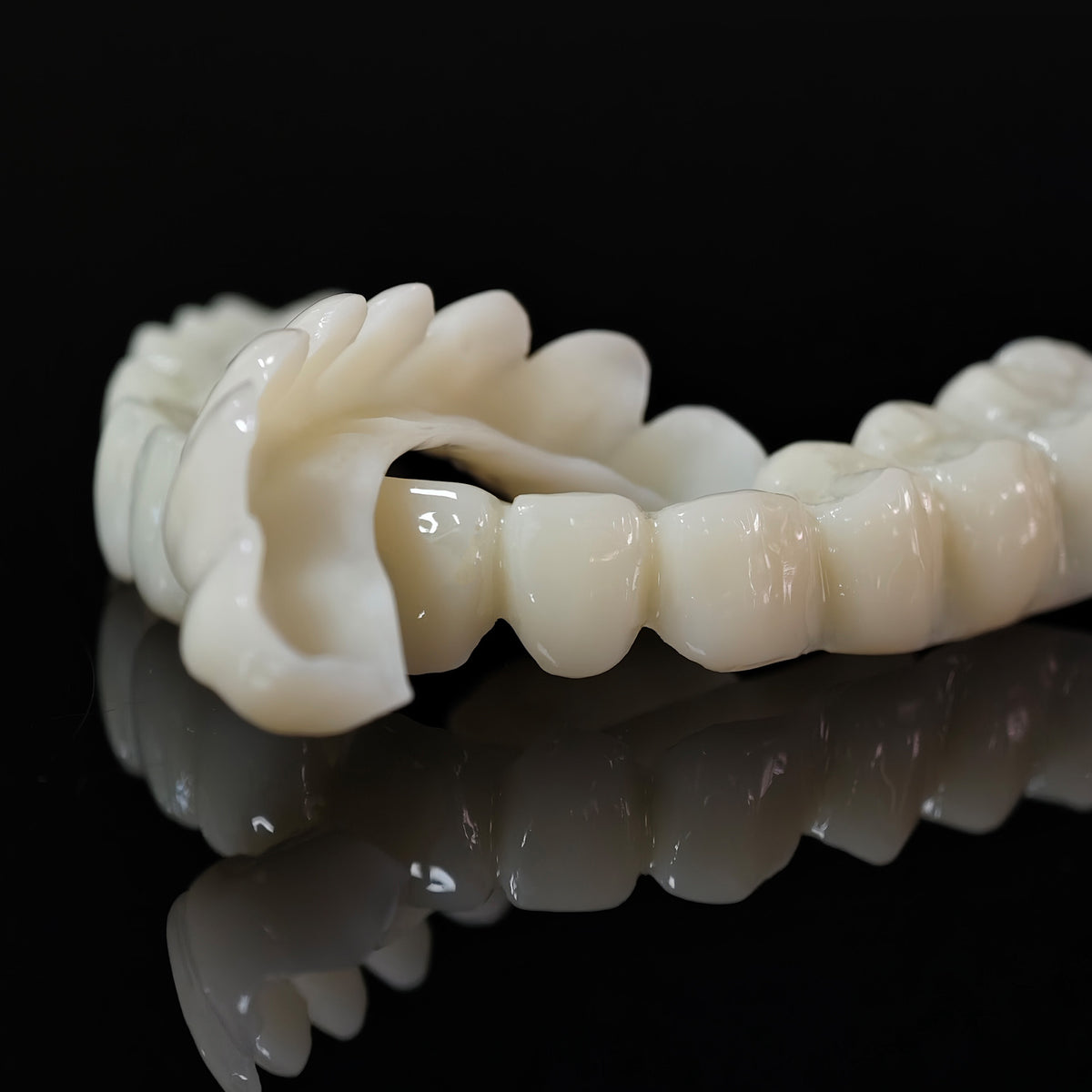 PMMA Bridge With Open Shell Preparing For Full Arch Dental Implants