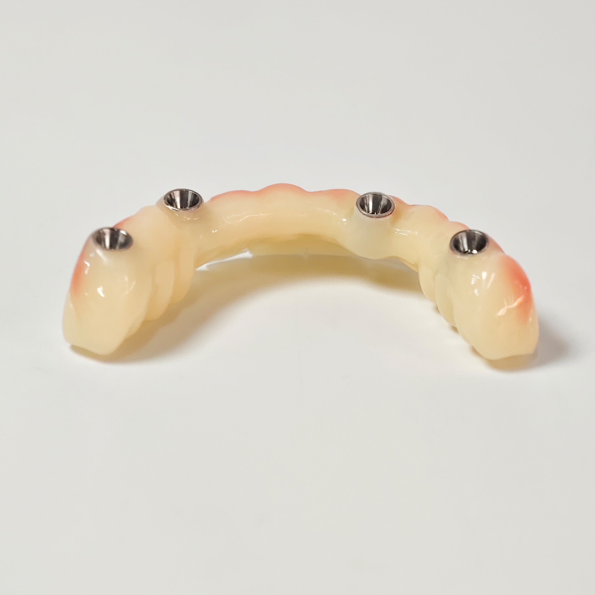 PMMA Bridge With Screw Retained