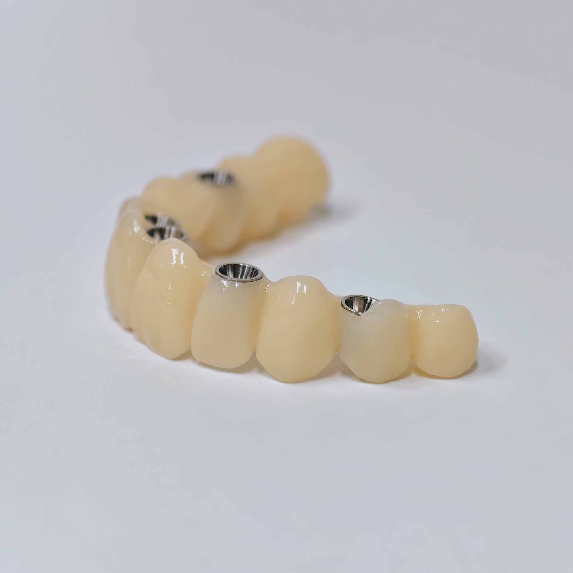PMMA Bridge With Screw Retained
