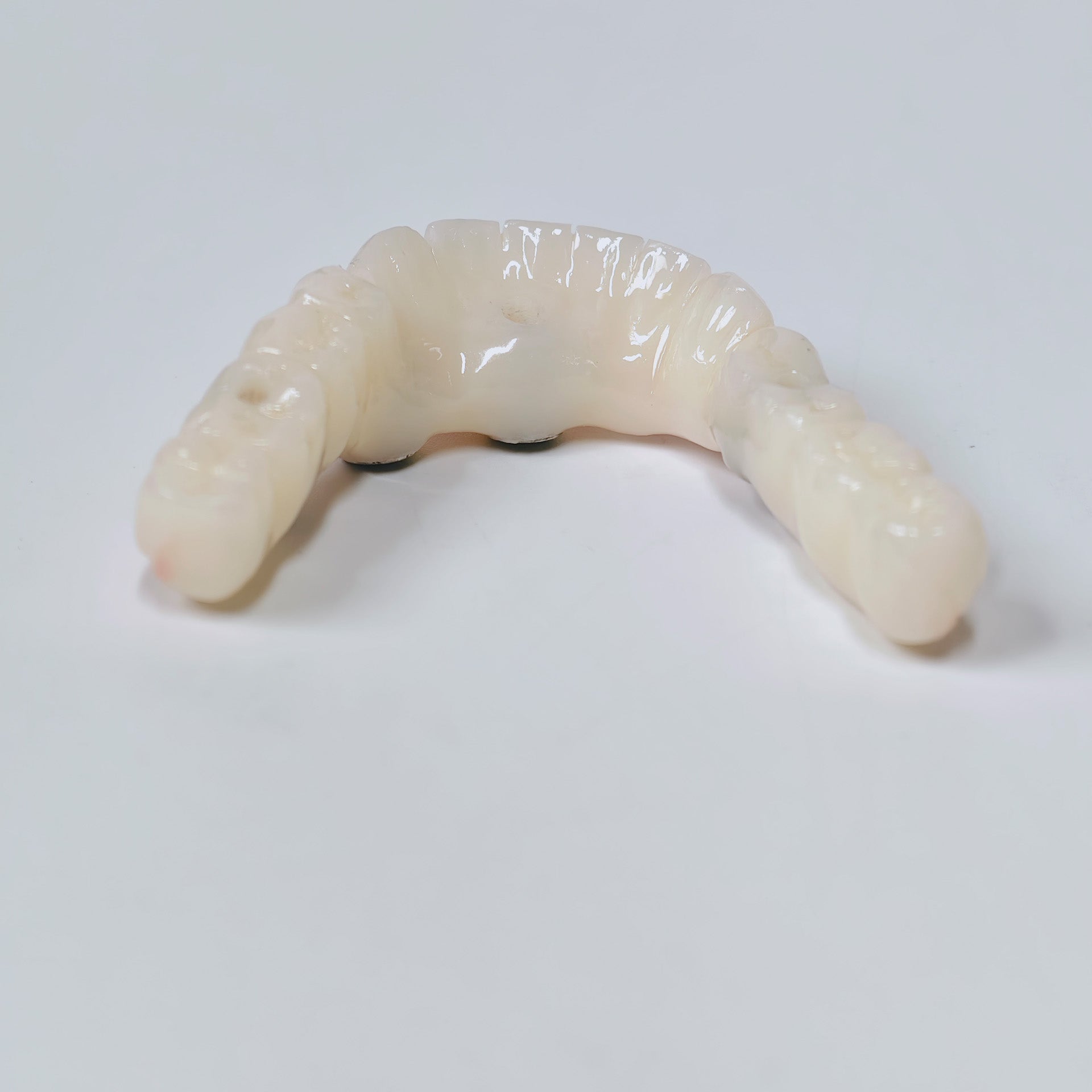 PMMA Bridge With Screw Retained