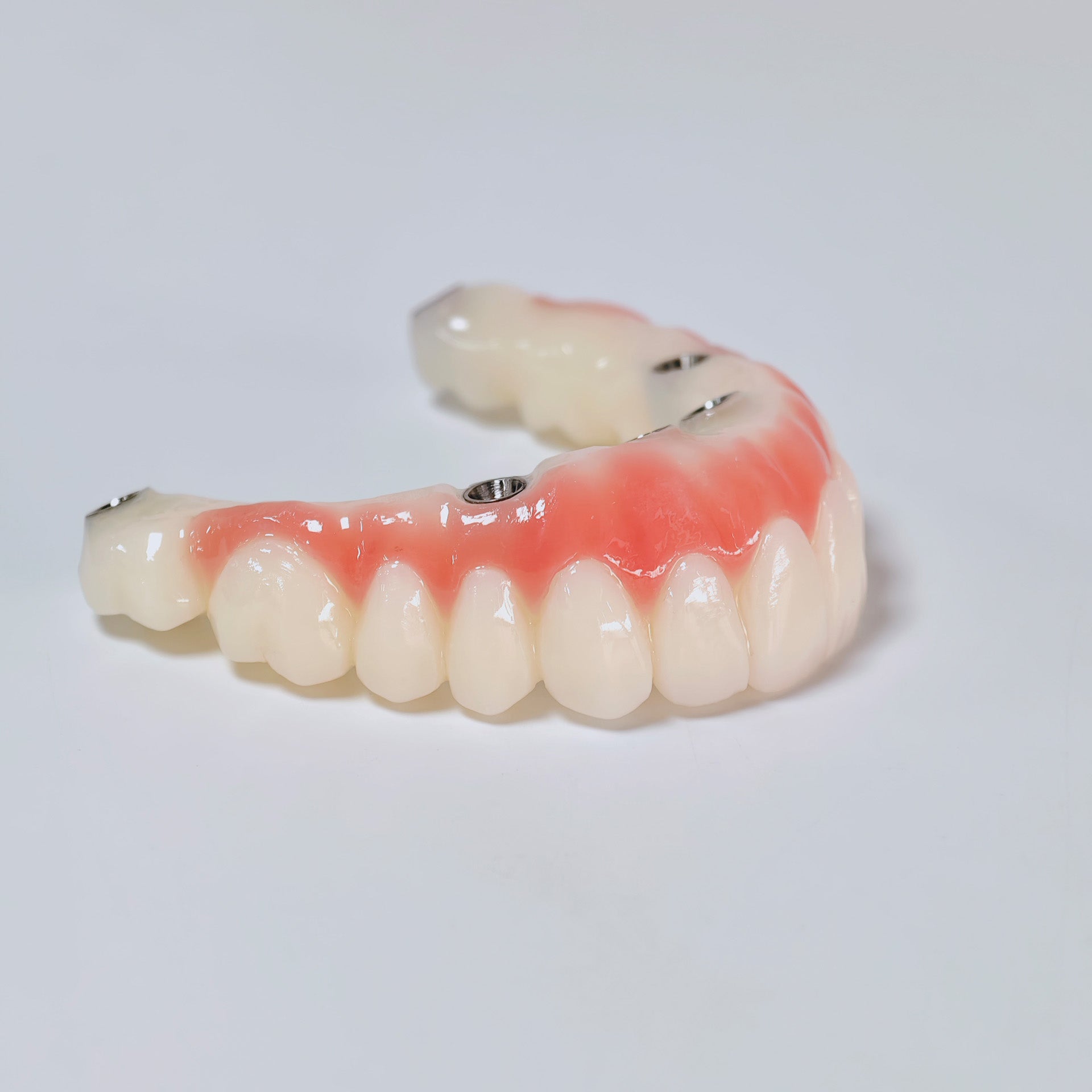 PMMA Bridge With Screw Retained