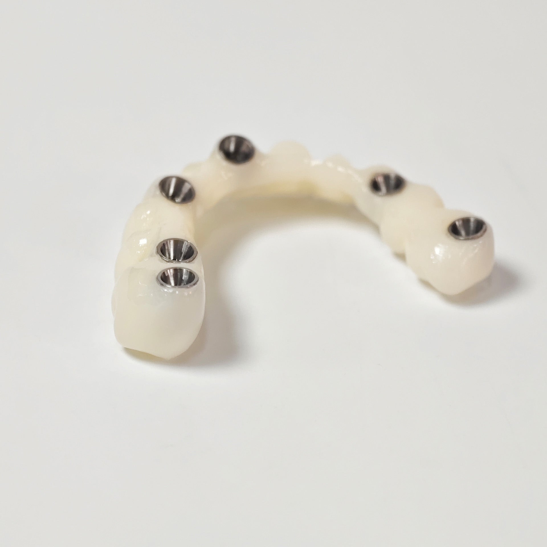 PMMA Bridge With Screw Retained
