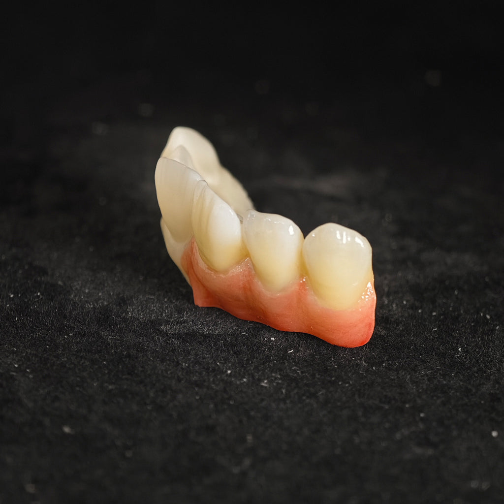 Ti-Bar Pure Titanium Metal Frame With Zirconia Bridge