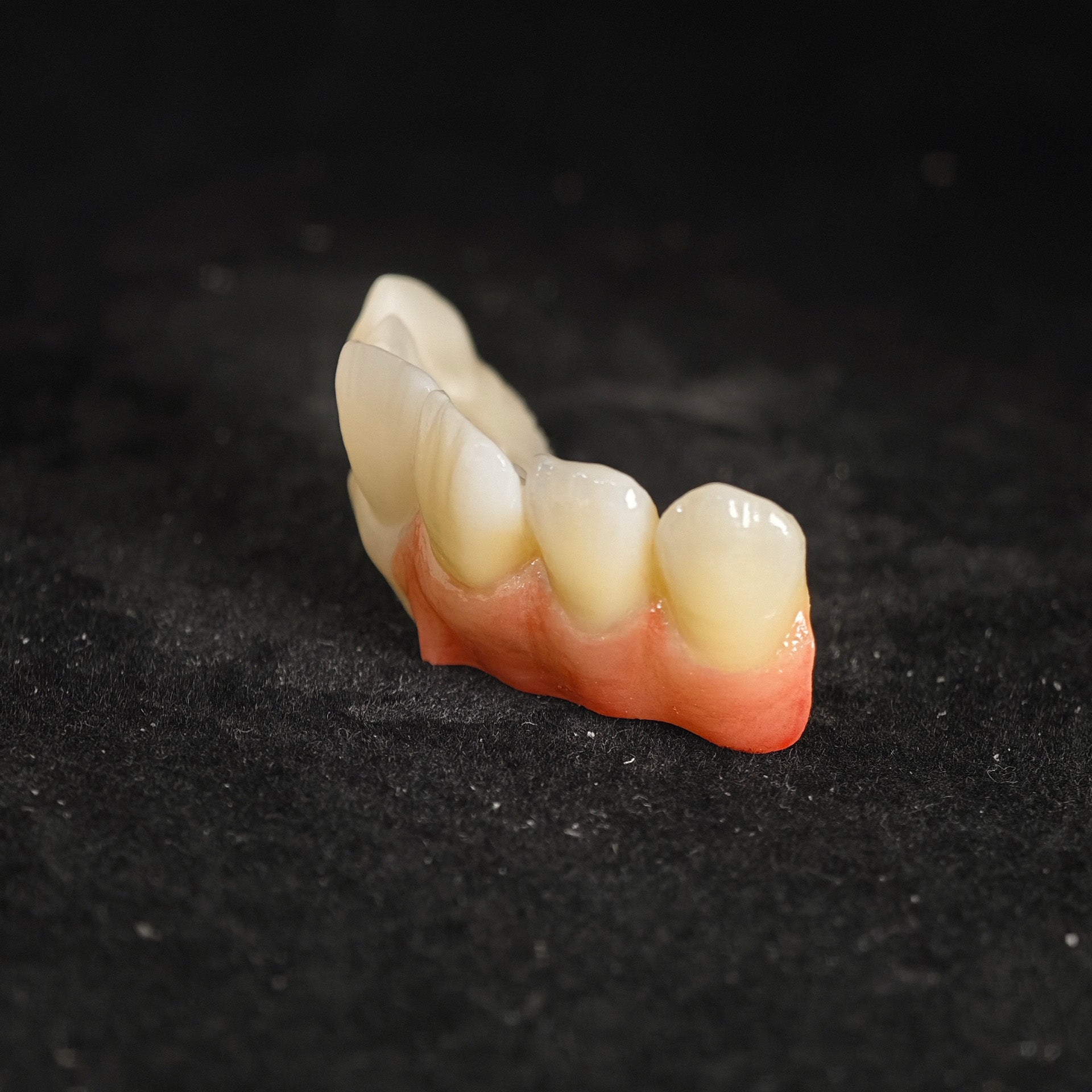 Ti-Bar Pure Titanium Metal Frame With Zirconia Bridge