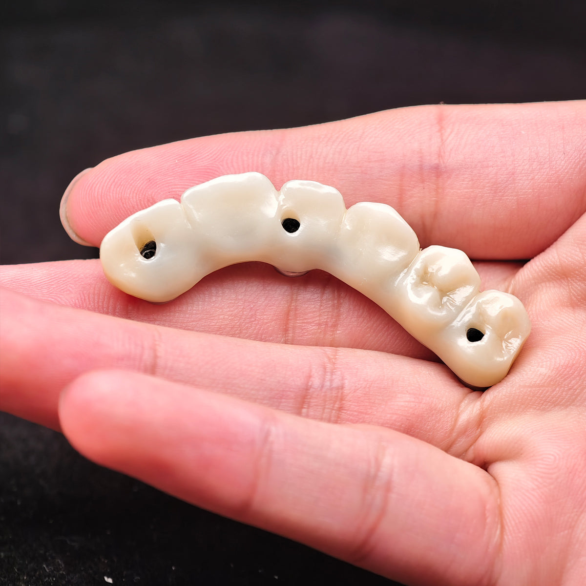 Ti-Bar Pure Titanium Metal Frame With Zirconia Bridge Implant