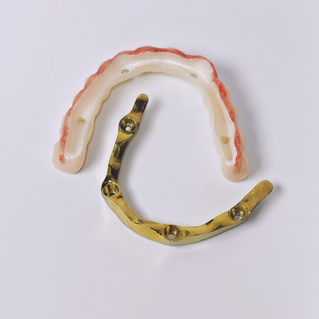 Ti-Bar Titanium Gold-Plated Metal Frame With Zirconia Bridge And Screw Retained