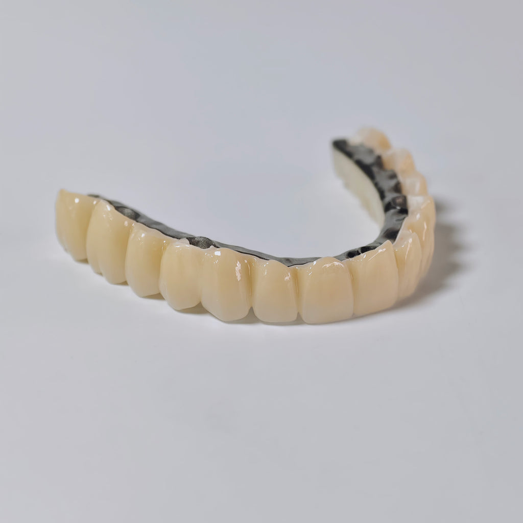 Ti-Bar Titanium Nitride Metal Frame With Zirconia Bridge And Cement Retained