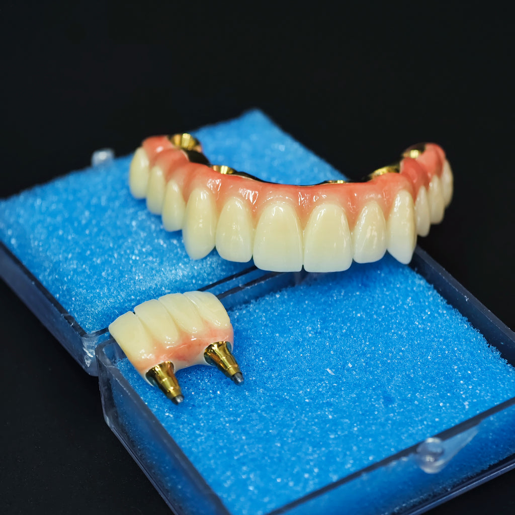 Ti-Bar Titanium Nitride Metal Frame With Zirconia Bridge For Full Arch Restoration