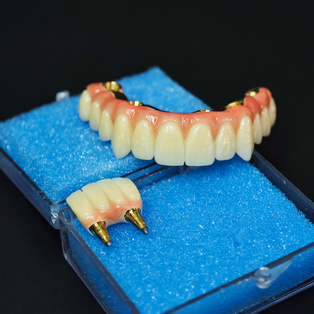 Ti-Bar Titanium Nitride Metal Frame With Zirconia Bridge For Full Arch Restoration