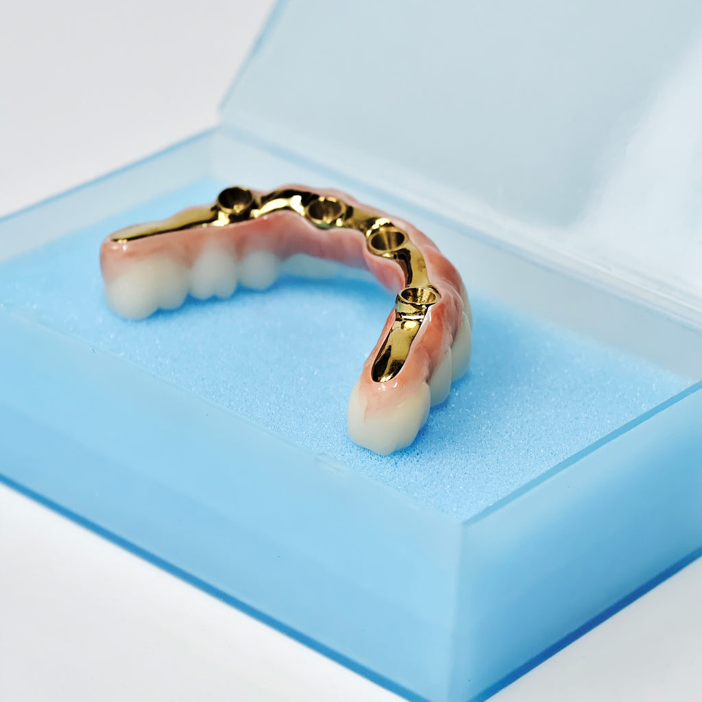 Ti-Bar Titanium Nitride Metal Frame With Zirconia Bridge For Full Arch Restoration