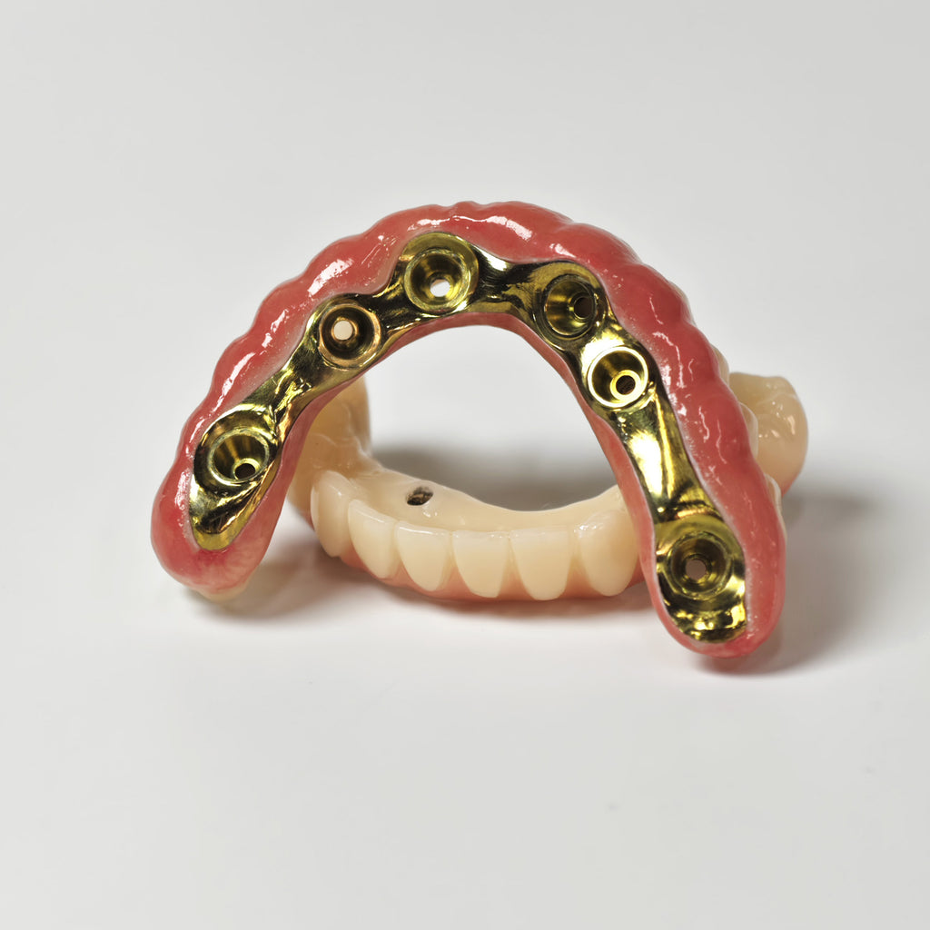 Ti-Bar Titanium Nitride Metal Frame With Zirconia Bridge For Full Arch Restoration