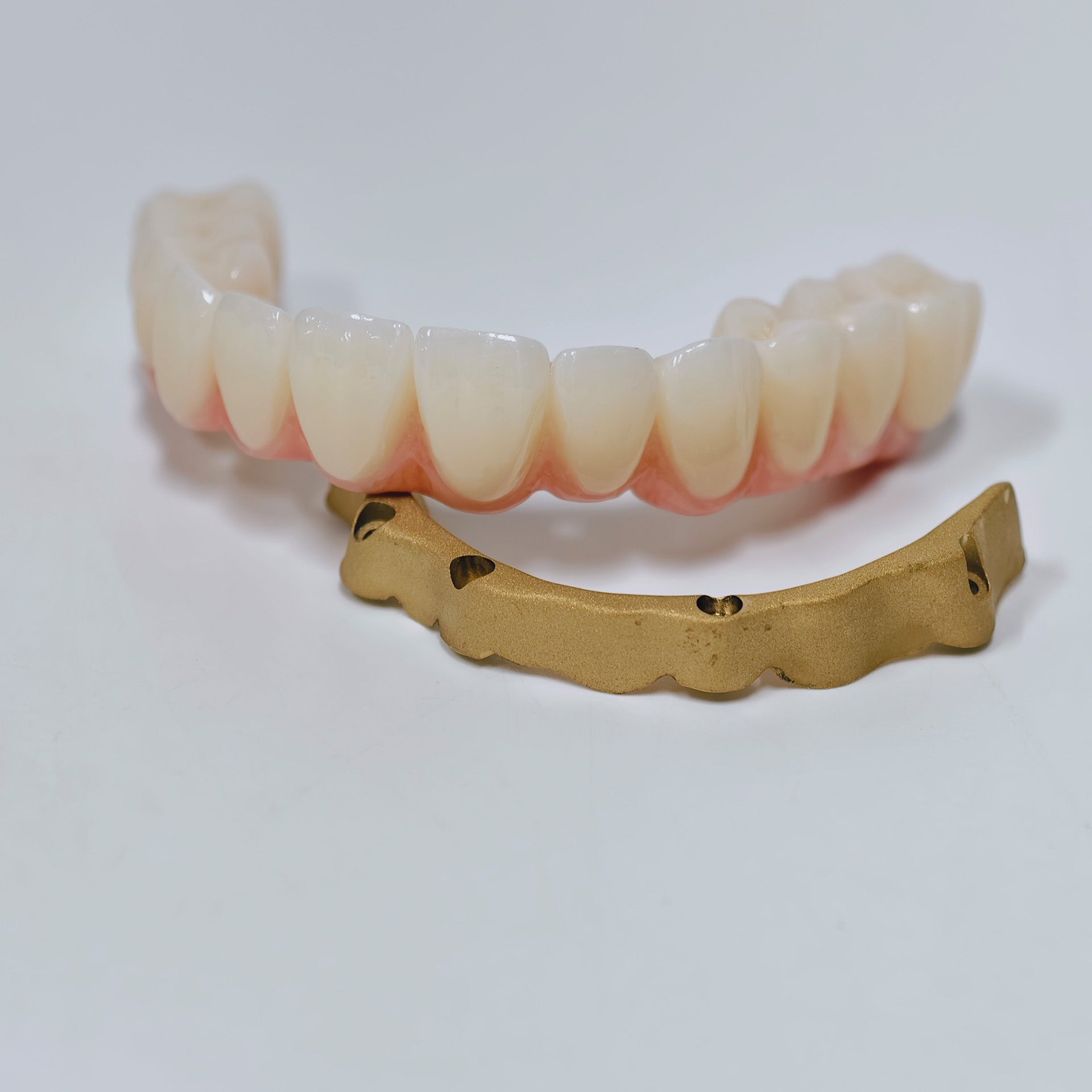 Ti-Bar Titanium Nitride Metal Frame With Zirconia Bridge For Full Arch Restoration